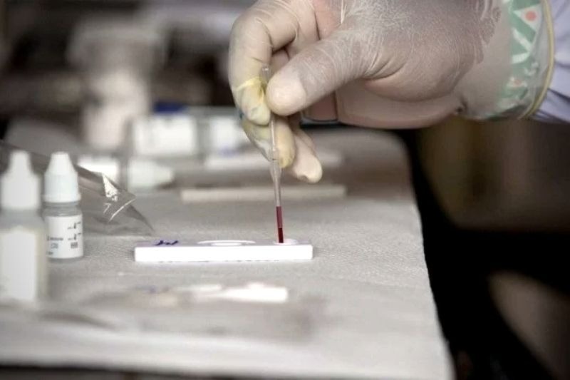 Hospital promove testagem gratuita de hepatites B e C em Curitiba