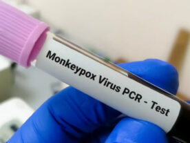 Varíola dos macacos: Anvisa cria Comitê Técnico da Emergência
