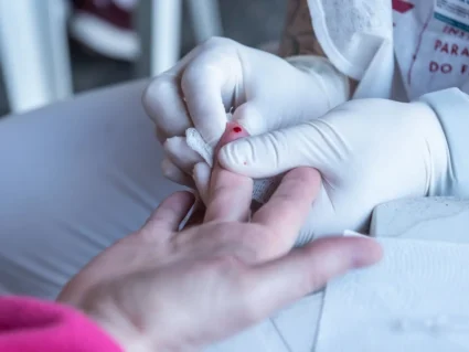 Surto de Hepatite A: Curitiba confirma novos casos da doença